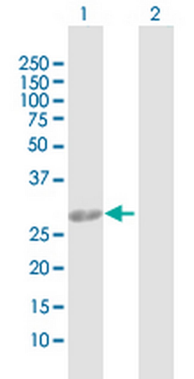 AK2 Antibody in Western Blot (WB)