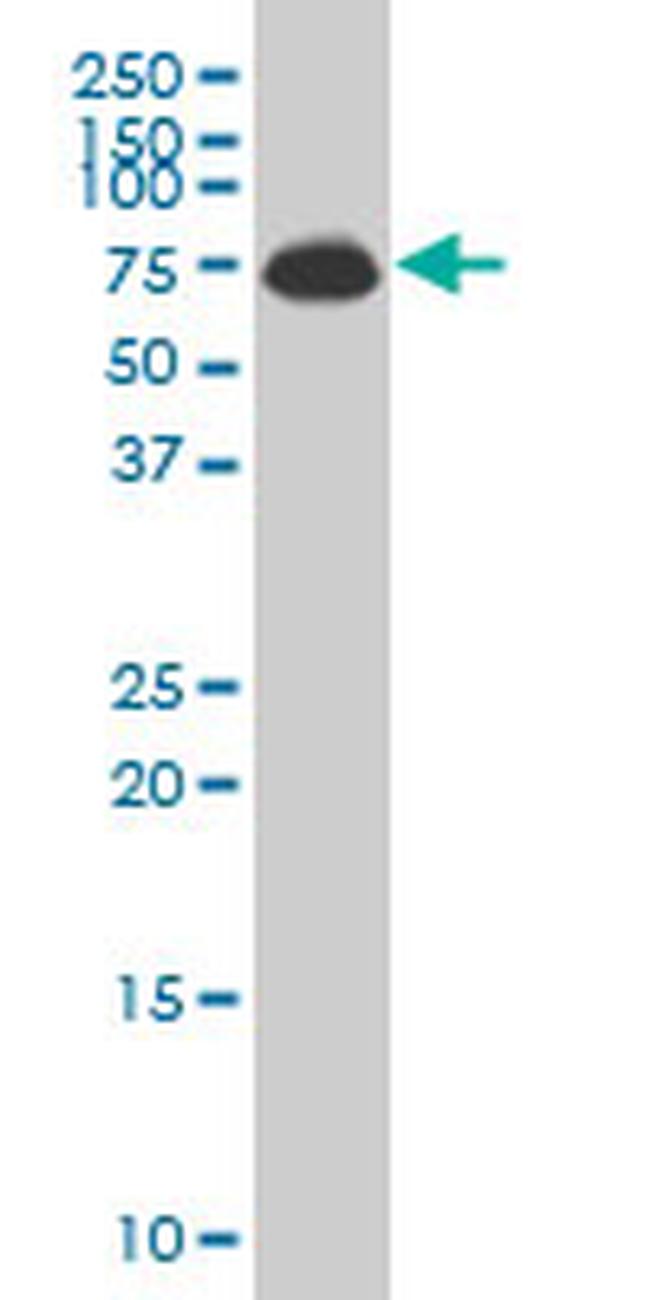 ALAS1 Antibody in Western Blot (WB)