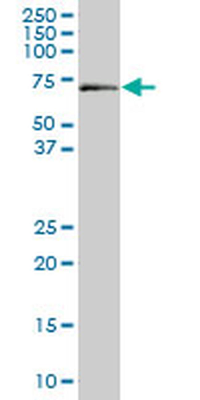 ALAS1 Antibody in Western Blot (WB)