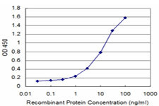 ALDH1A1 Antibody in ELISA (ELISA)
