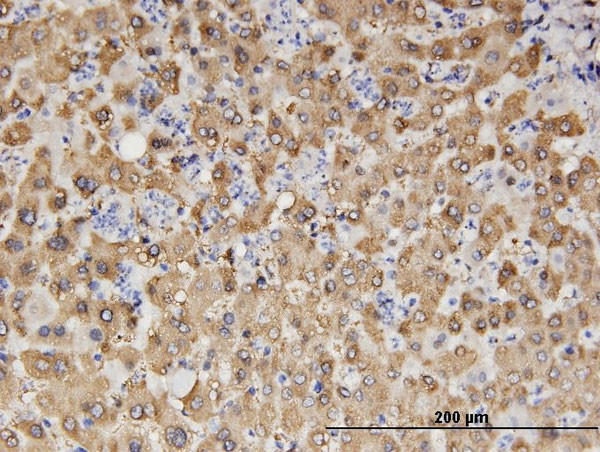 ALDH1A1 Antibody in Immunohistochemistry (Paraffin) (IHC (P))