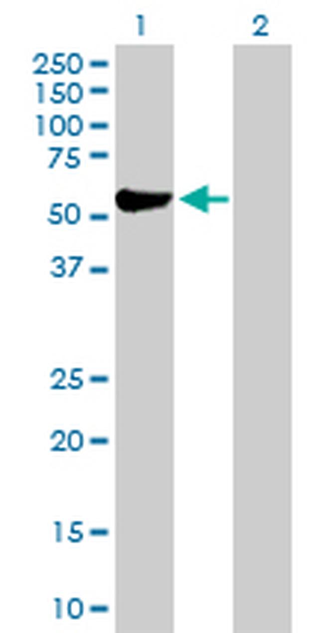 ALDH3A1 Antibody in Western Blot (WB)