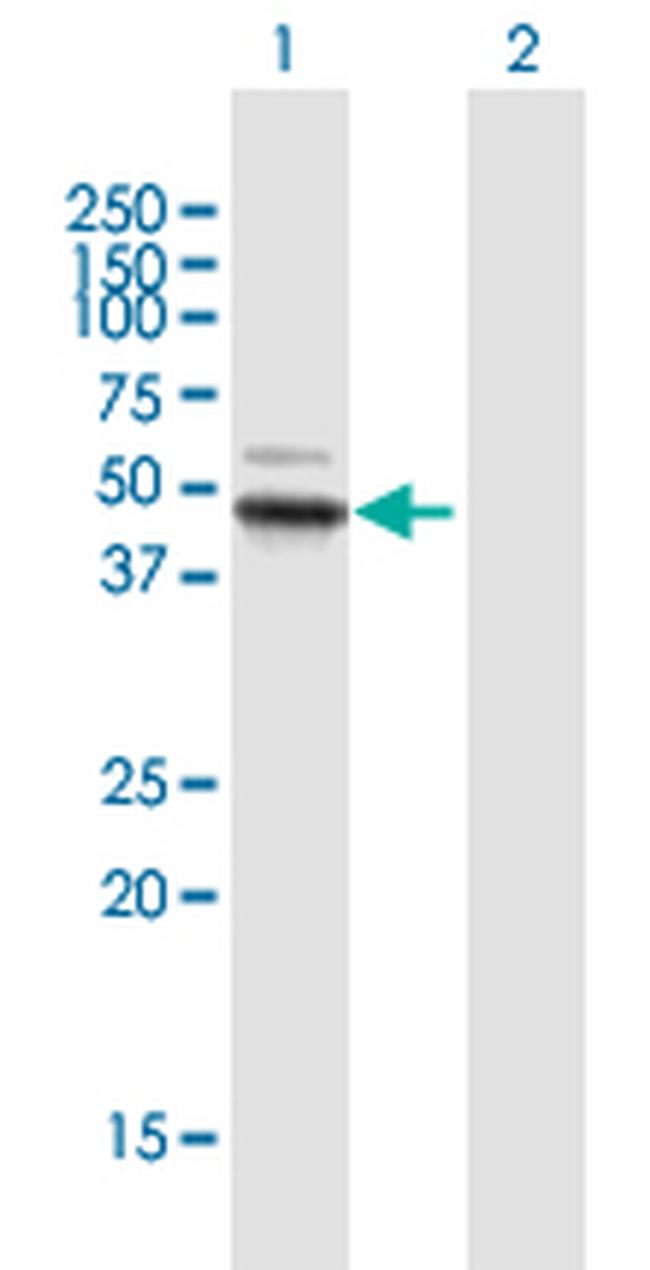 ALDH3B1 Antibody in Western Blot (WB)