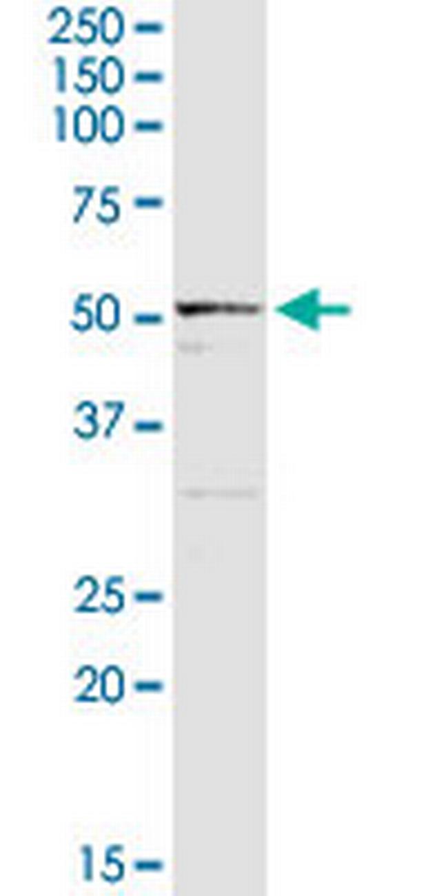 ALDH3B1 Antibody in Western Blot (WB)