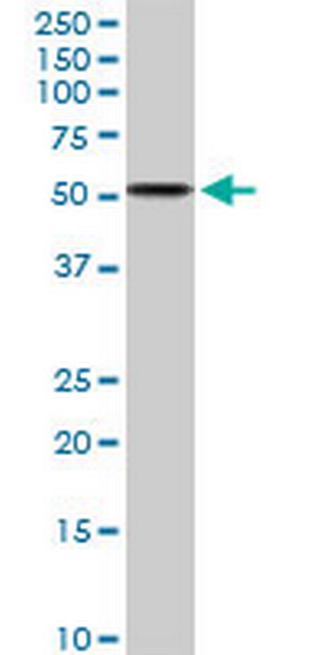 ALDH3A2 Antibody in Western Blot (WB)