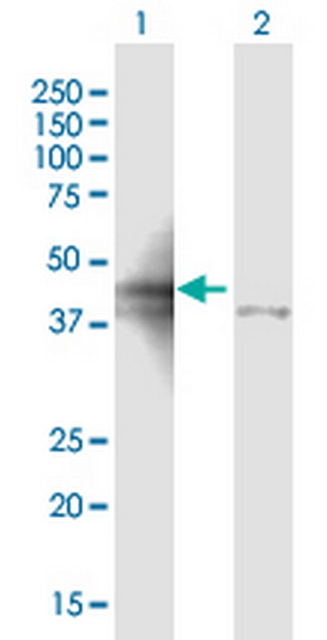 ALDOA Antibody in Western Blot (WB)
