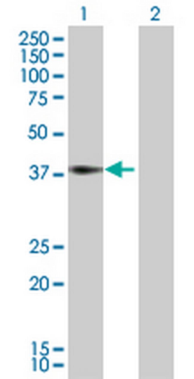 ALDOA Antibody in Western Blot (WB)