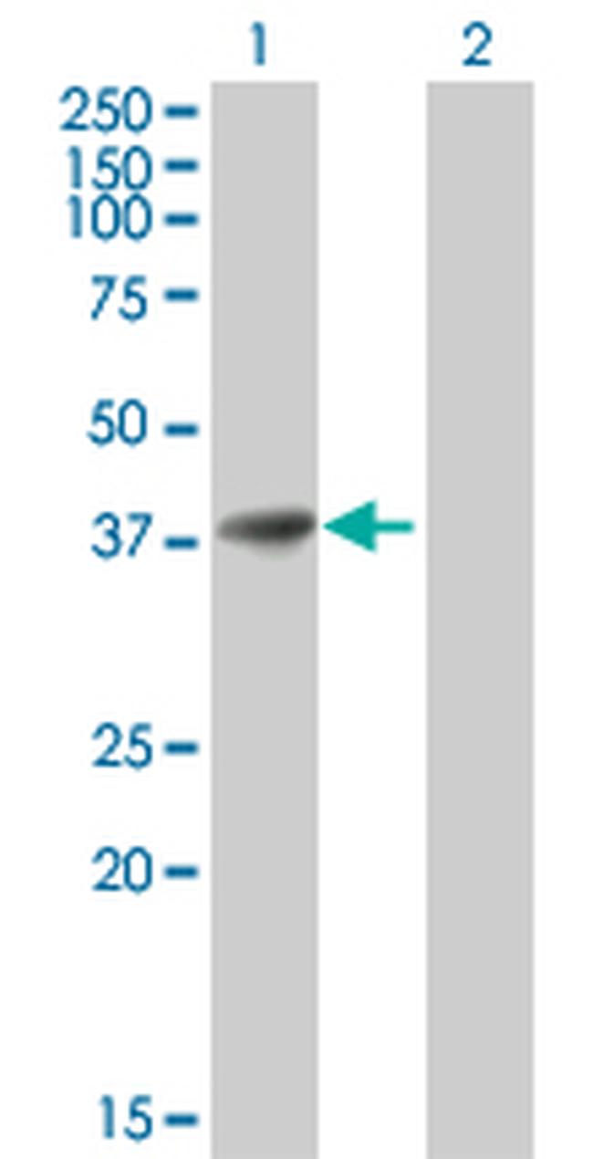 AKR1B1 Antibody in Western Blot (WB)