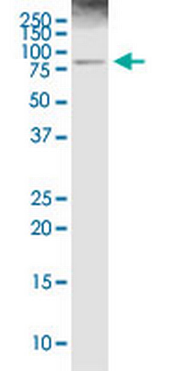 ALOX5 Antibody in Western Blot (WB)