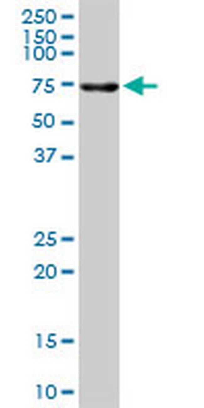 ALPPL2 Antibody in Western Blot (WB)