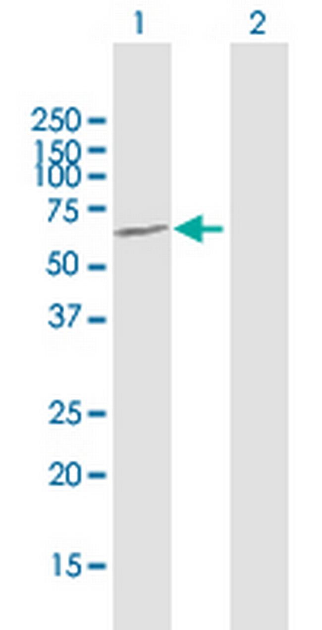 AMBN Antibody in Western Blot (WB)