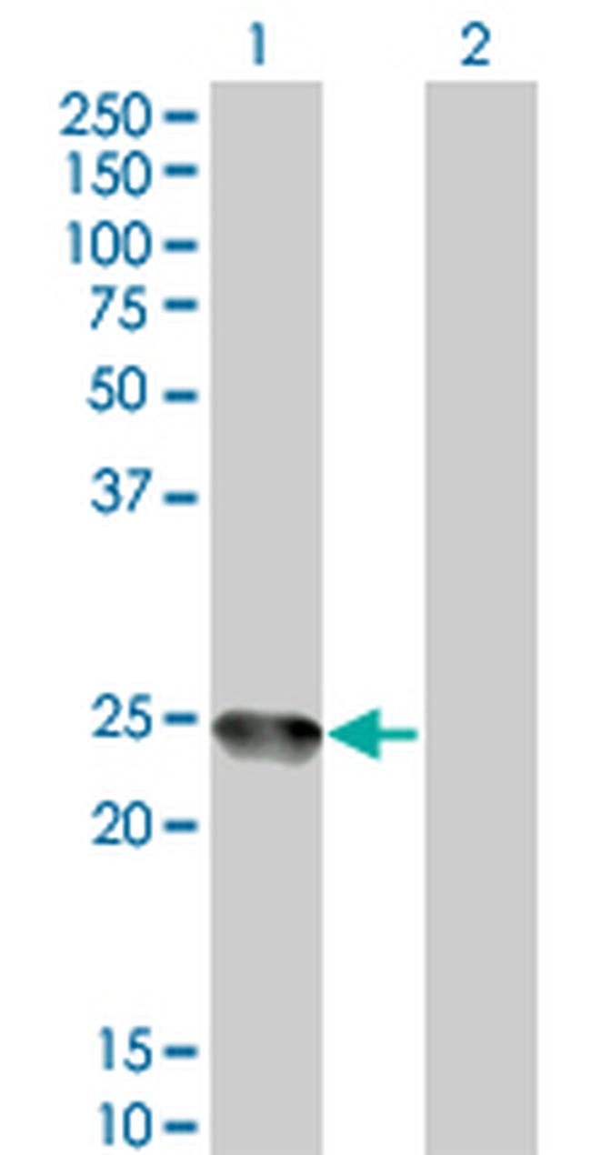 AMELX Antibody in Western Blot (WB)