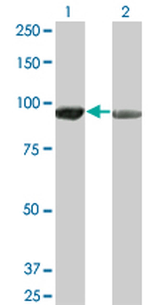 AMPD2 Antibody in Western Blot (WB)