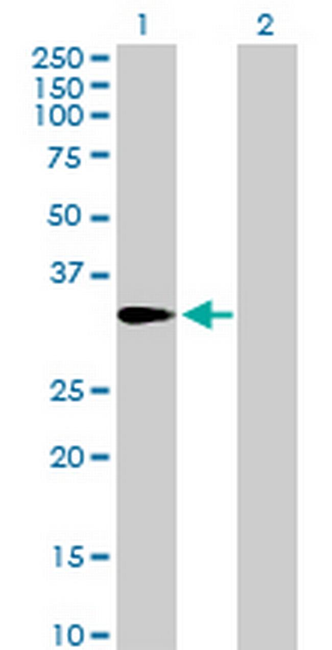 AMT Antibody in Western Blot (WB)