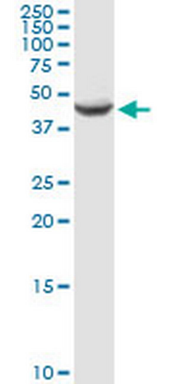 AMT Antibody in Western Blot (WB)