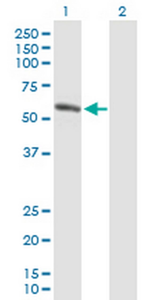 AMY1B Antibody in Western Blot (WB)