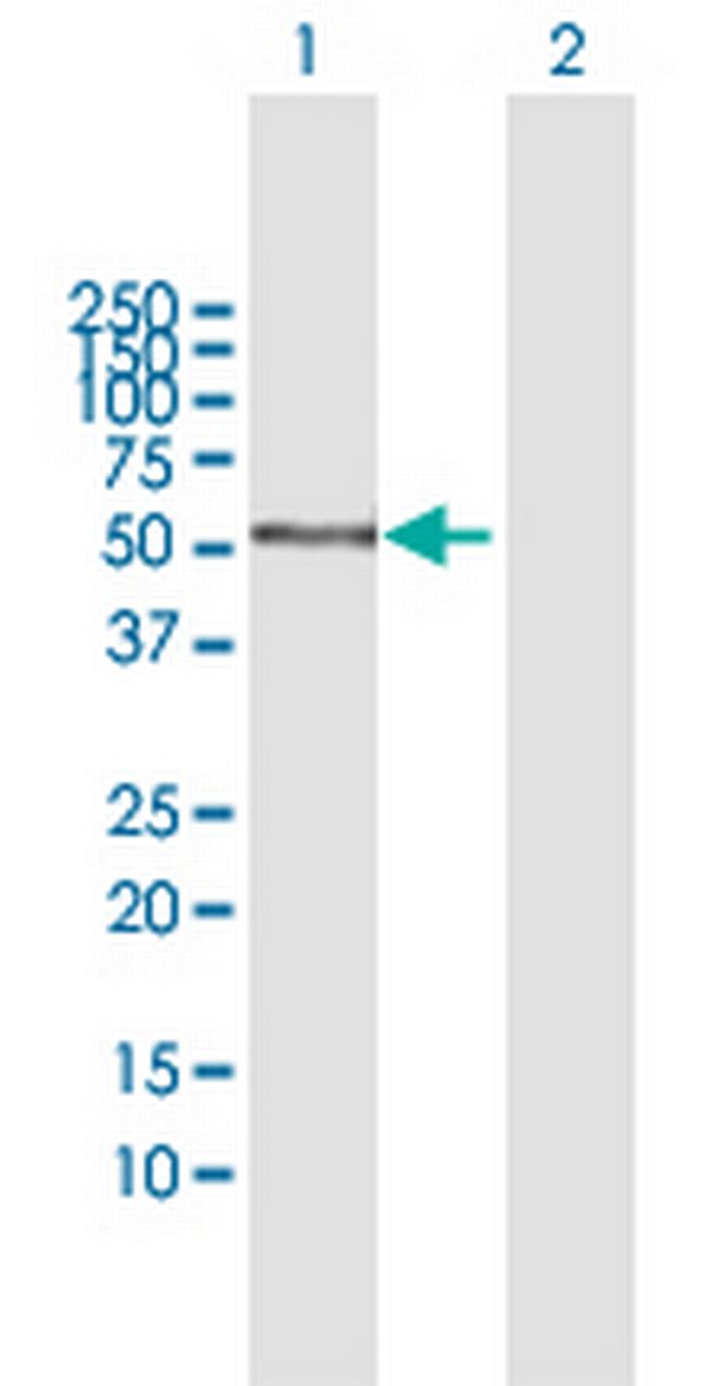 AMY1C Antibody in Western Blot (WB)