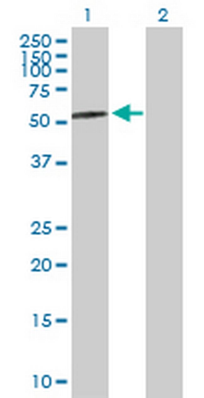 AMY2A Antibody in Western Blot (WB)