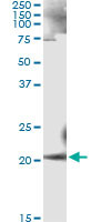 ANK1 Antibody in Immunoprecipitation (IP)