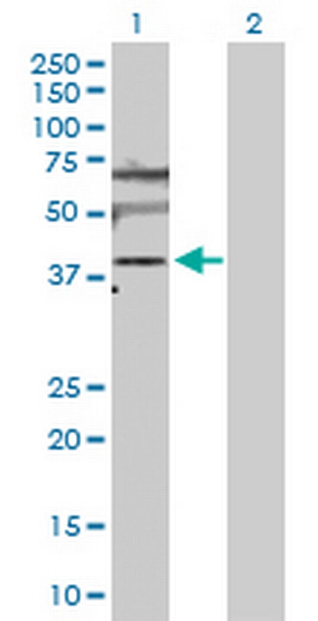 SLC25A6 Antibody in Western Blot (WB)