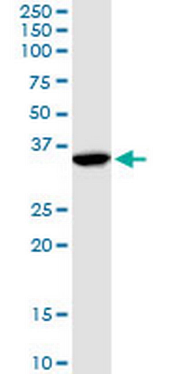 ANXA1 Antibody in Western Blot (WB)