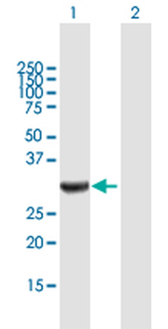 ANXA3 Antibody in Western Blot (WB)