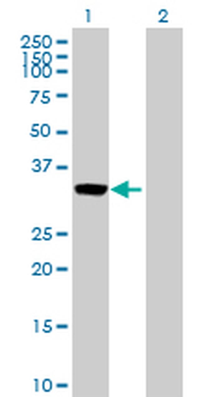 ANXA3 Antibody in Western Blot (WB)