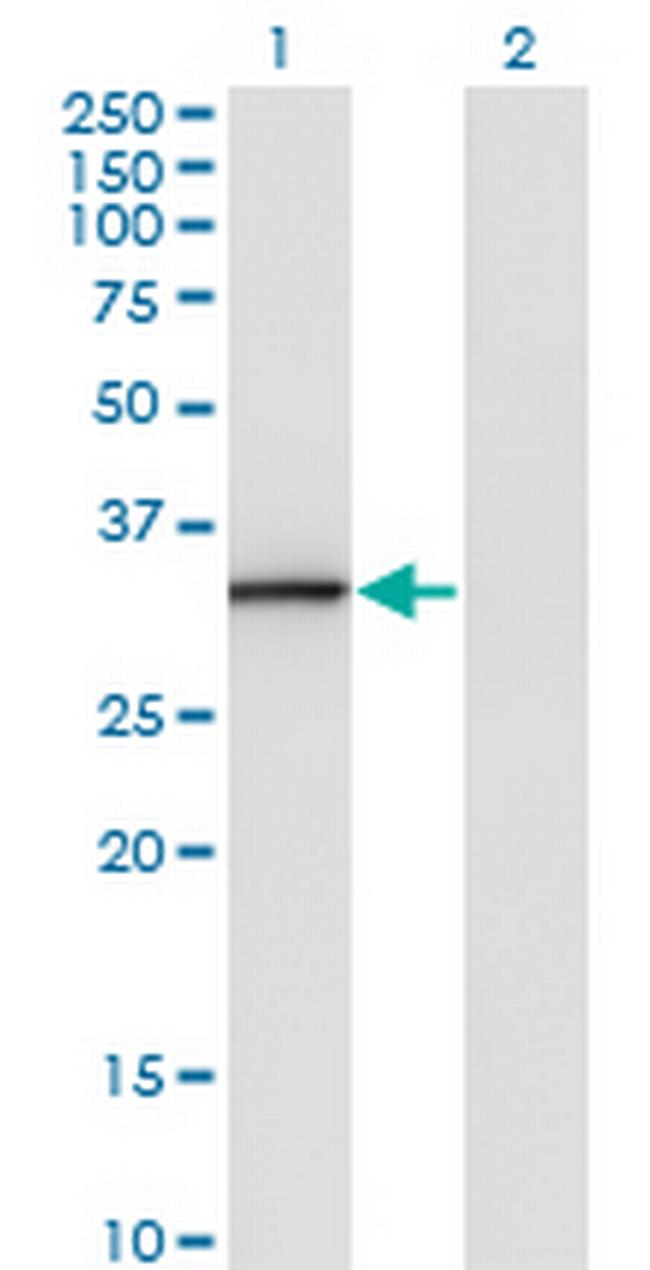 ANXA3 Antibody in Western Blot (WB)