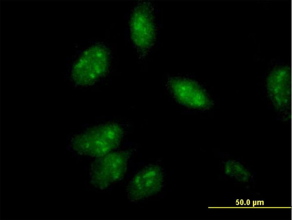 ANXA4 Antibody in Immunocytochemistry (ICC/IF)