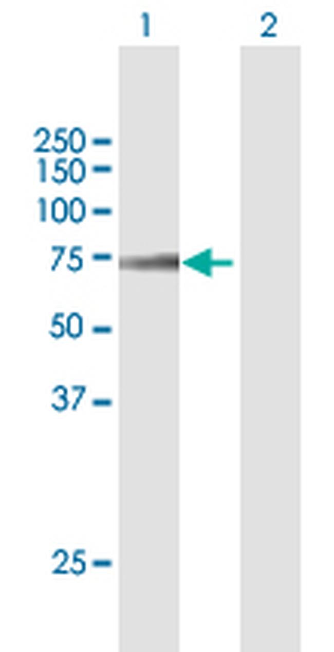 AOAH Antibody in Western Blot (WB)