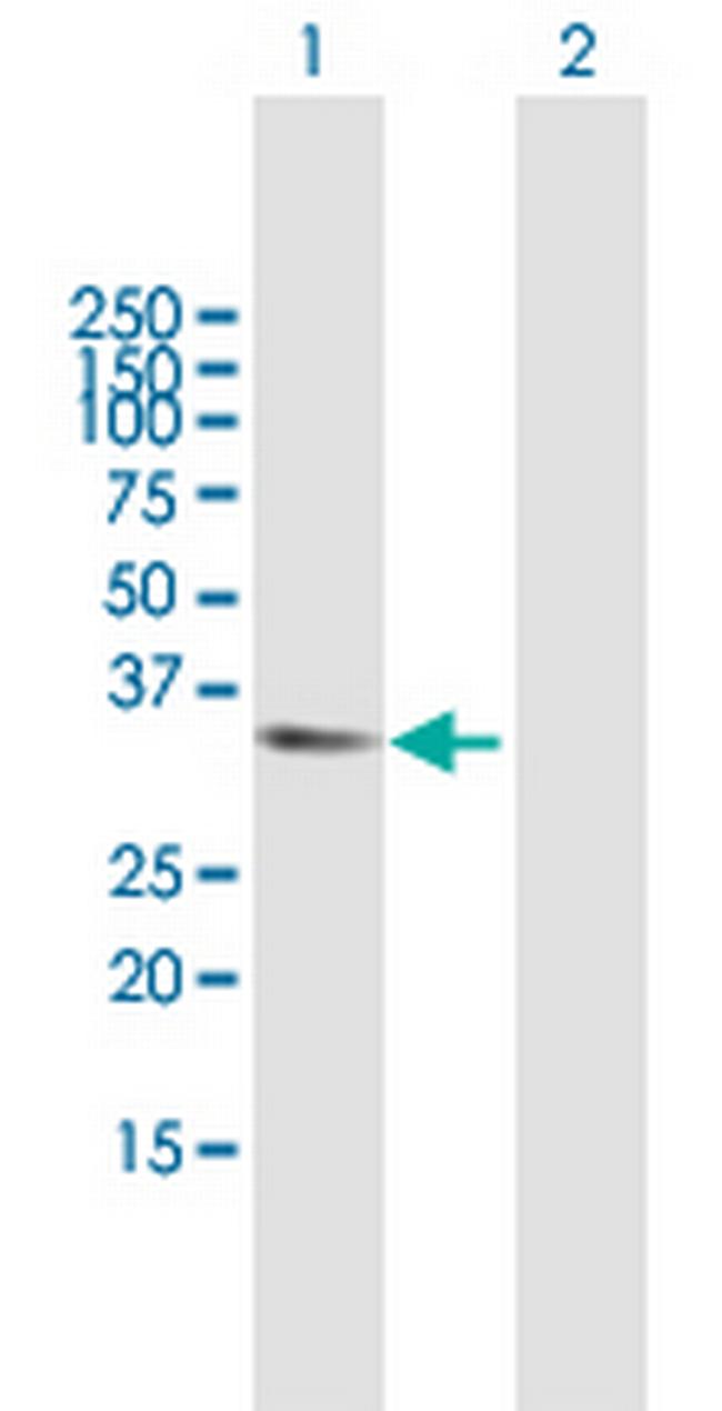 APBB2 Antibody in Western Blot (WB)