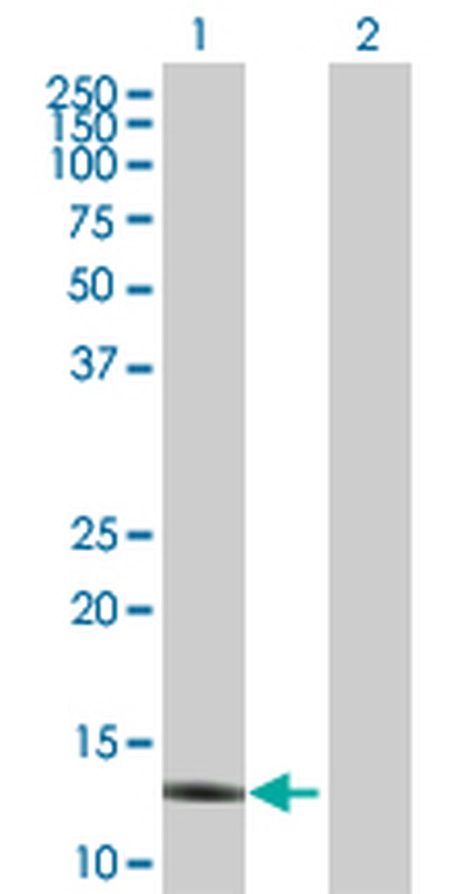 APOC4 Antibody in Western Blot (WB)