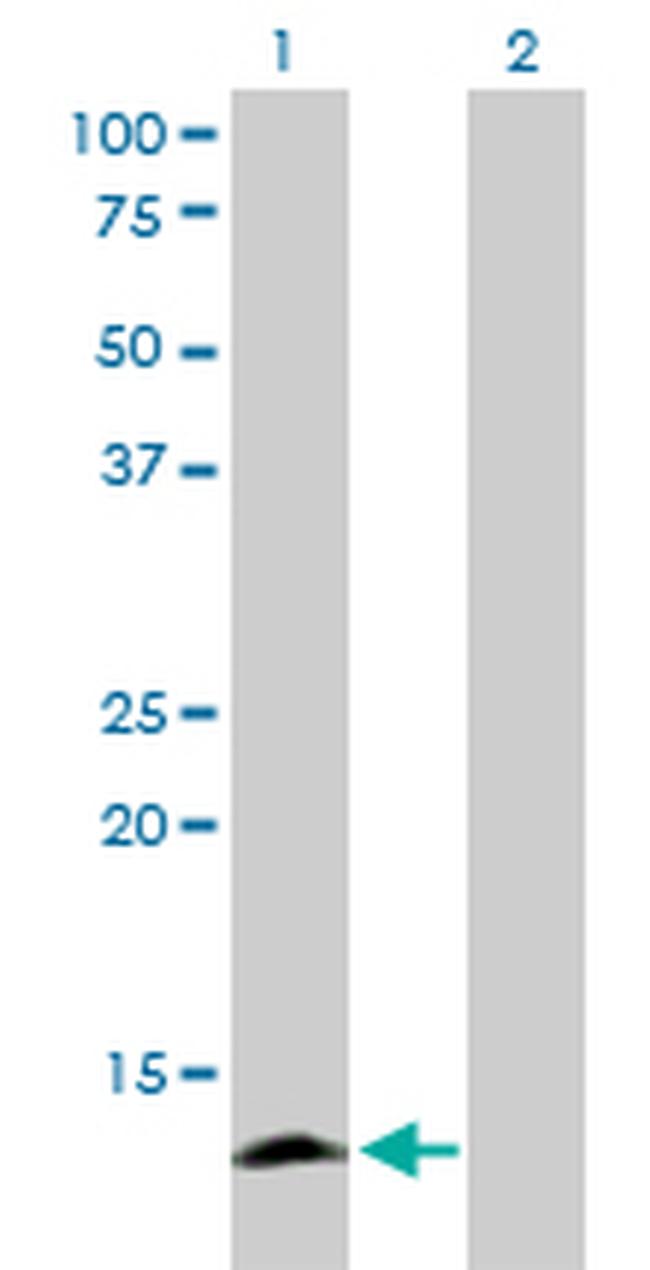 APOC4 Antibody in Western Blot (WB)