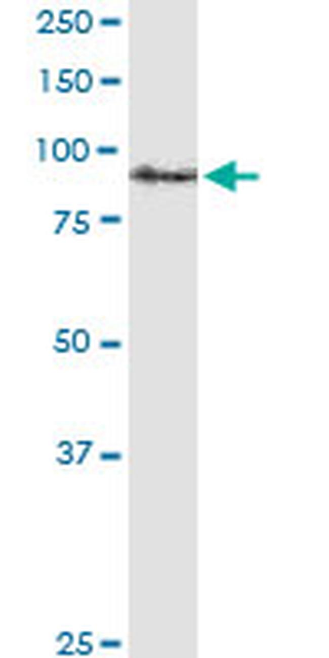 APP Antibody in Western Blot (WB)