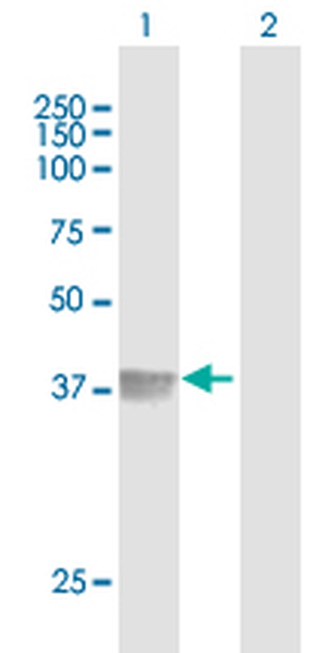 FAS Antibody in Western Blot (WB)