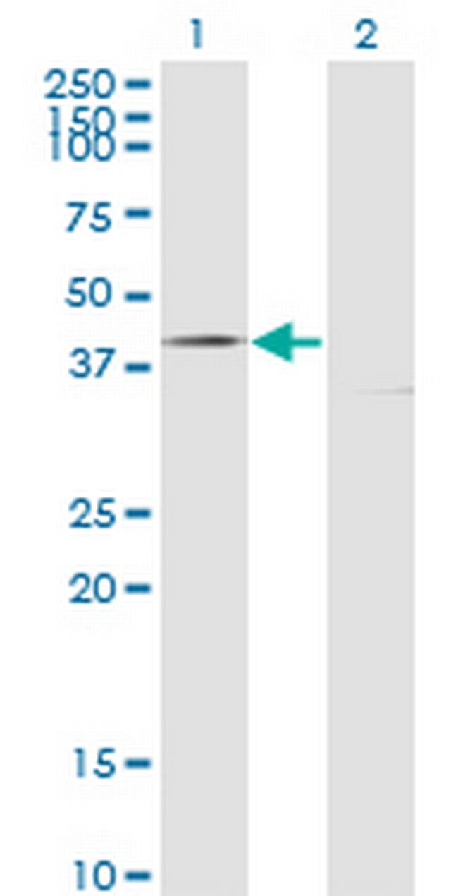 FAS Antibody in Western Blot (WB)