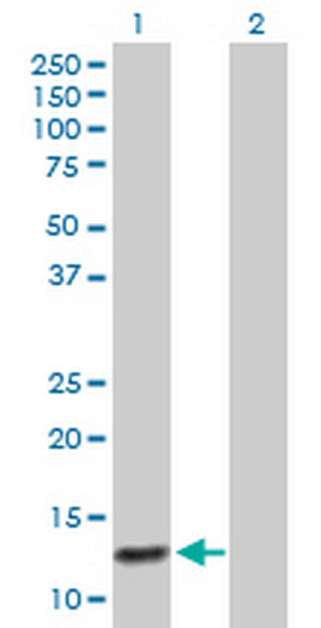 ABCC6 Antibody in Western Blot (WB)