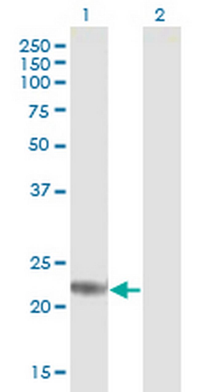 ARL4D Antibody in Western Blot (WB)