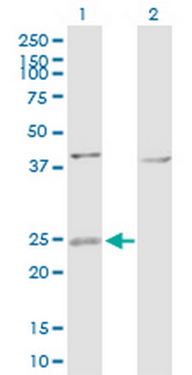 ARL4D Antibody in Western Blot (WB)