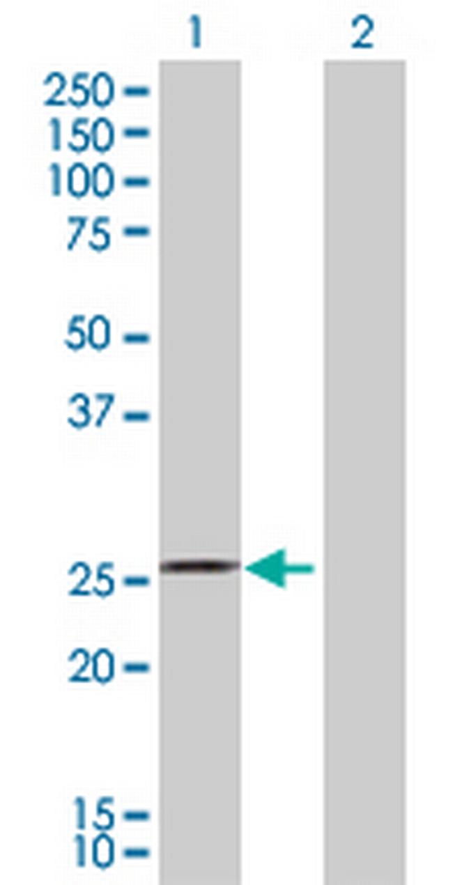 RHOA Antibody in Western Blot (WB)