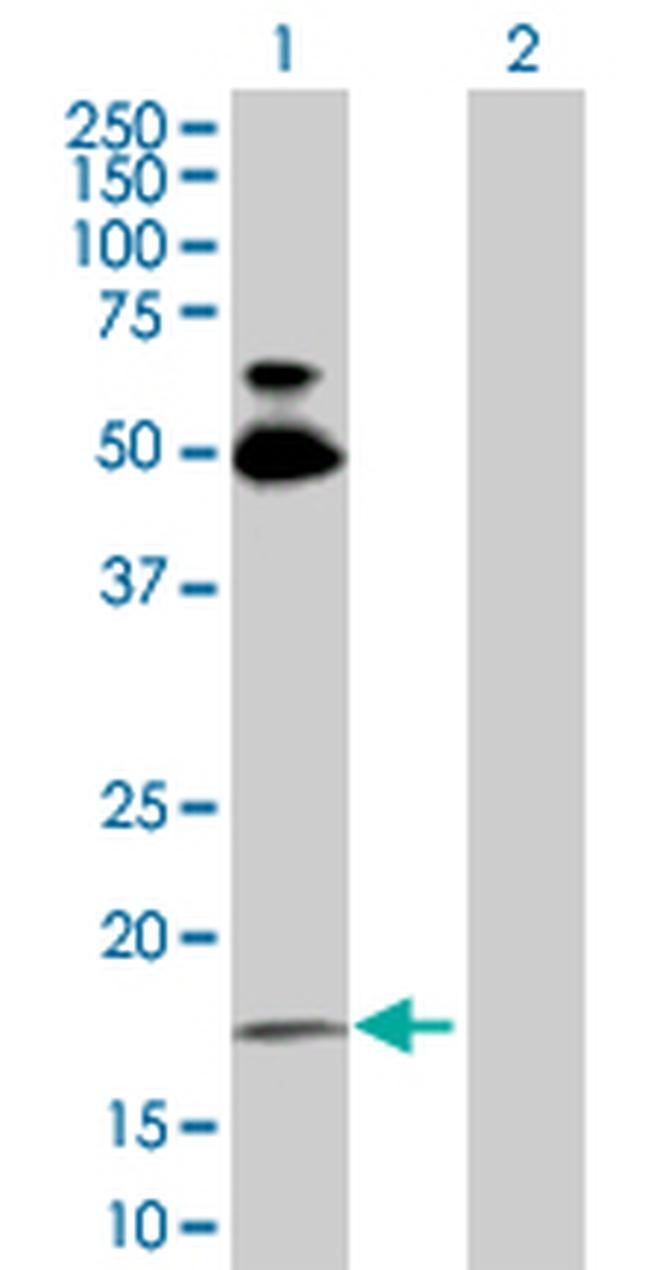 RHOB Antibody in Western Blot (WB)
