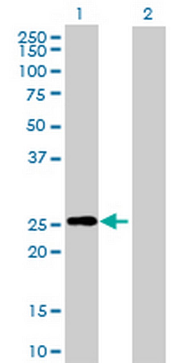 RND3 Antibody in Western Blot (WB)