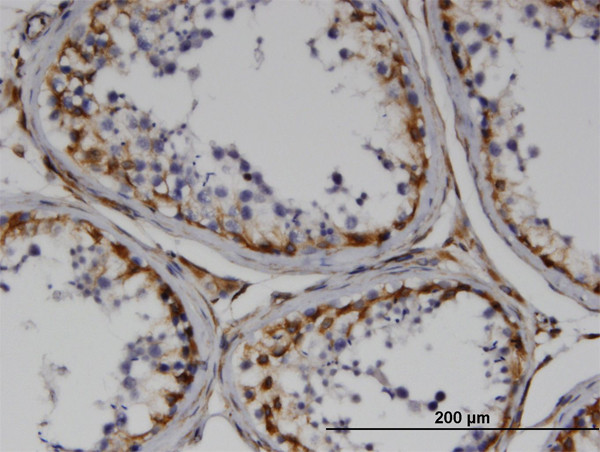 RND3 Antibody in Immunohistochemistry (Paraffin) (IHC (P))