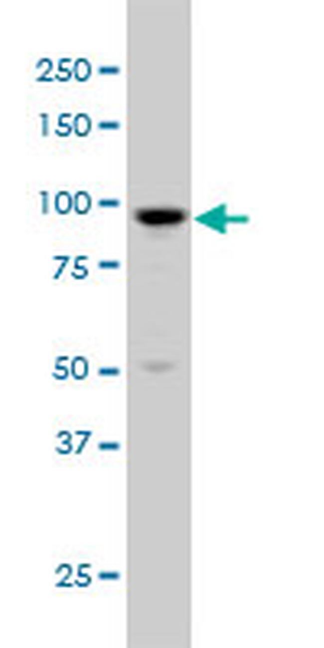 ARHGAP6 Antibody in Western Blot (WB)