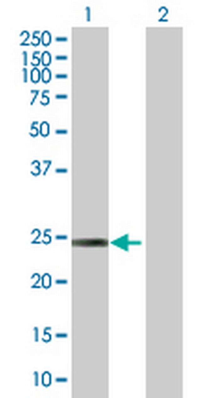 ARHGDIB Antibody in Western Blot (WB)