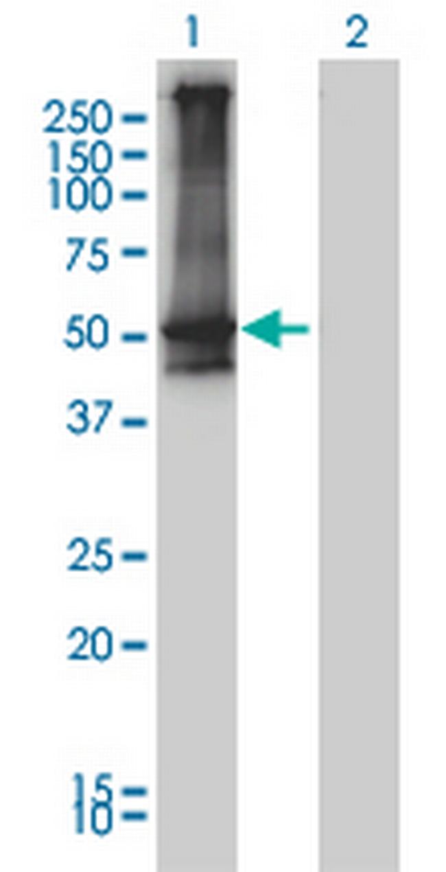 ARRB2 Antibody in Western Blot (WB)