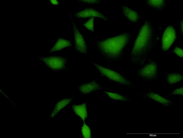 ARRB2 Antibody in Immunocytochemistry (ICC/IF)