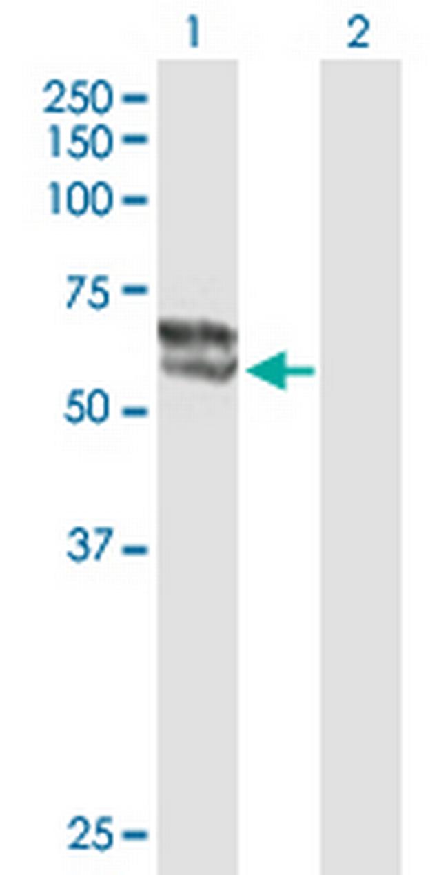 STS Antibody in Western Blot (WB)
