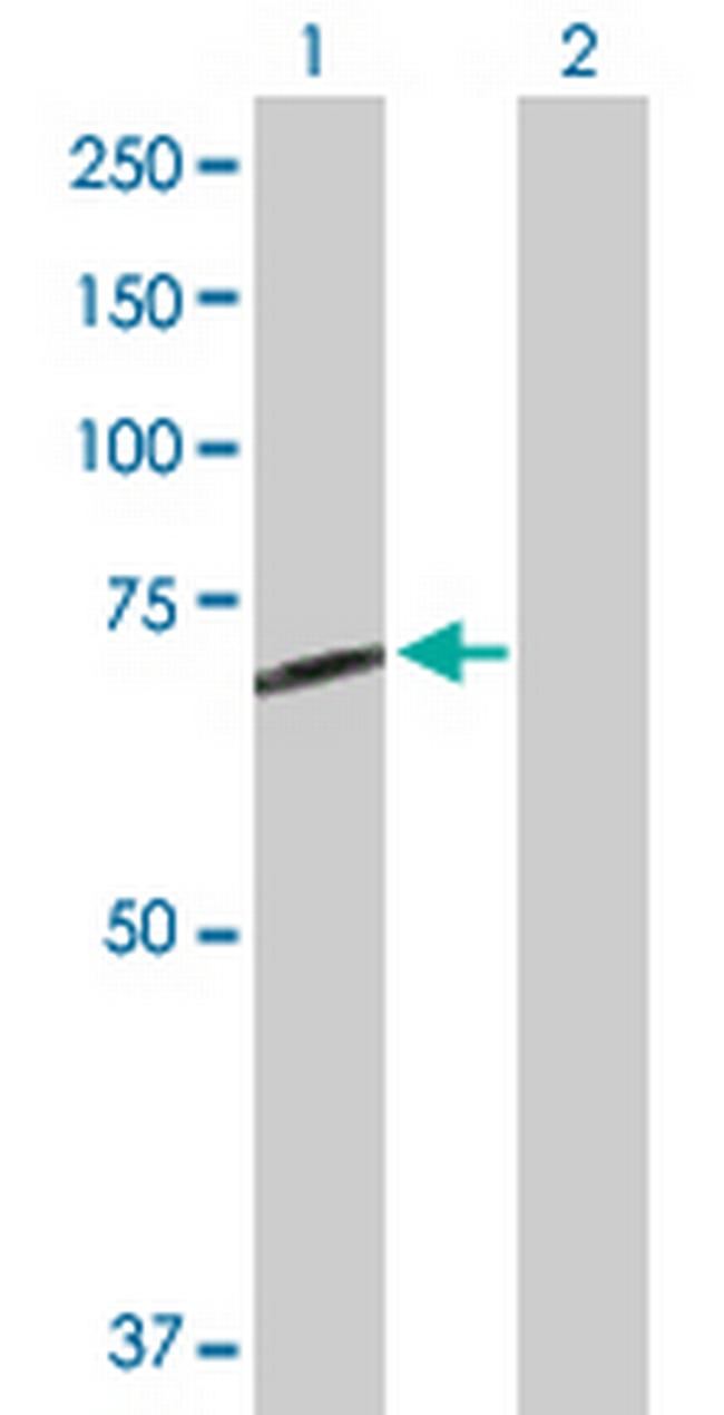 STS Antibody in Western Blot (WB)