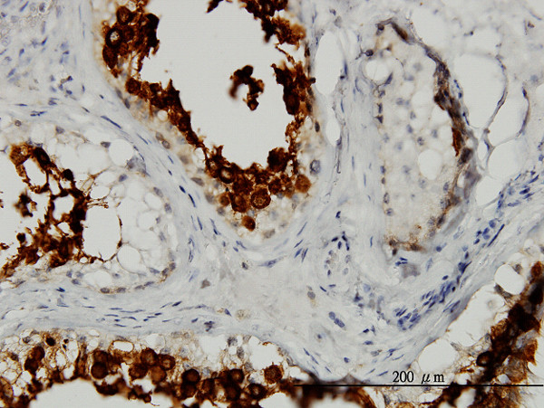 ART3 Antibody in Immunohistochemistry (Paraffin) (IHC (P))
